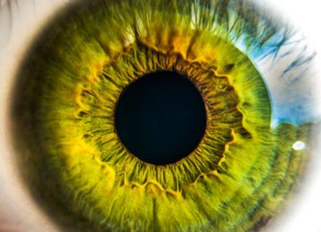 Nevritis vidnega živca – optični nevritis