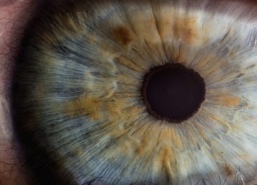 Trahom – očesna okužba